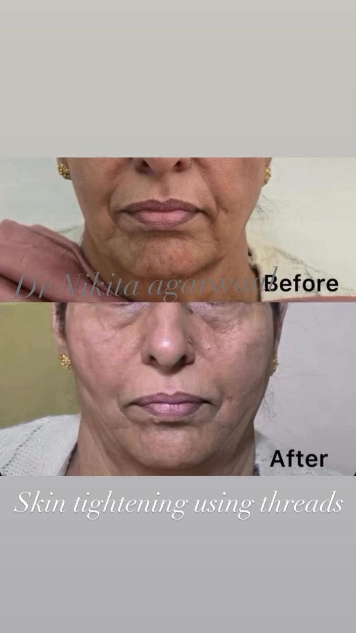 Healthy radiant skin result